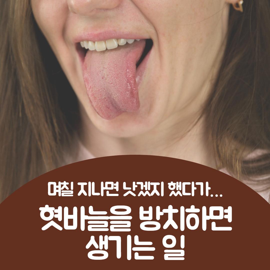 혓바늘 없애는법 1.jpg