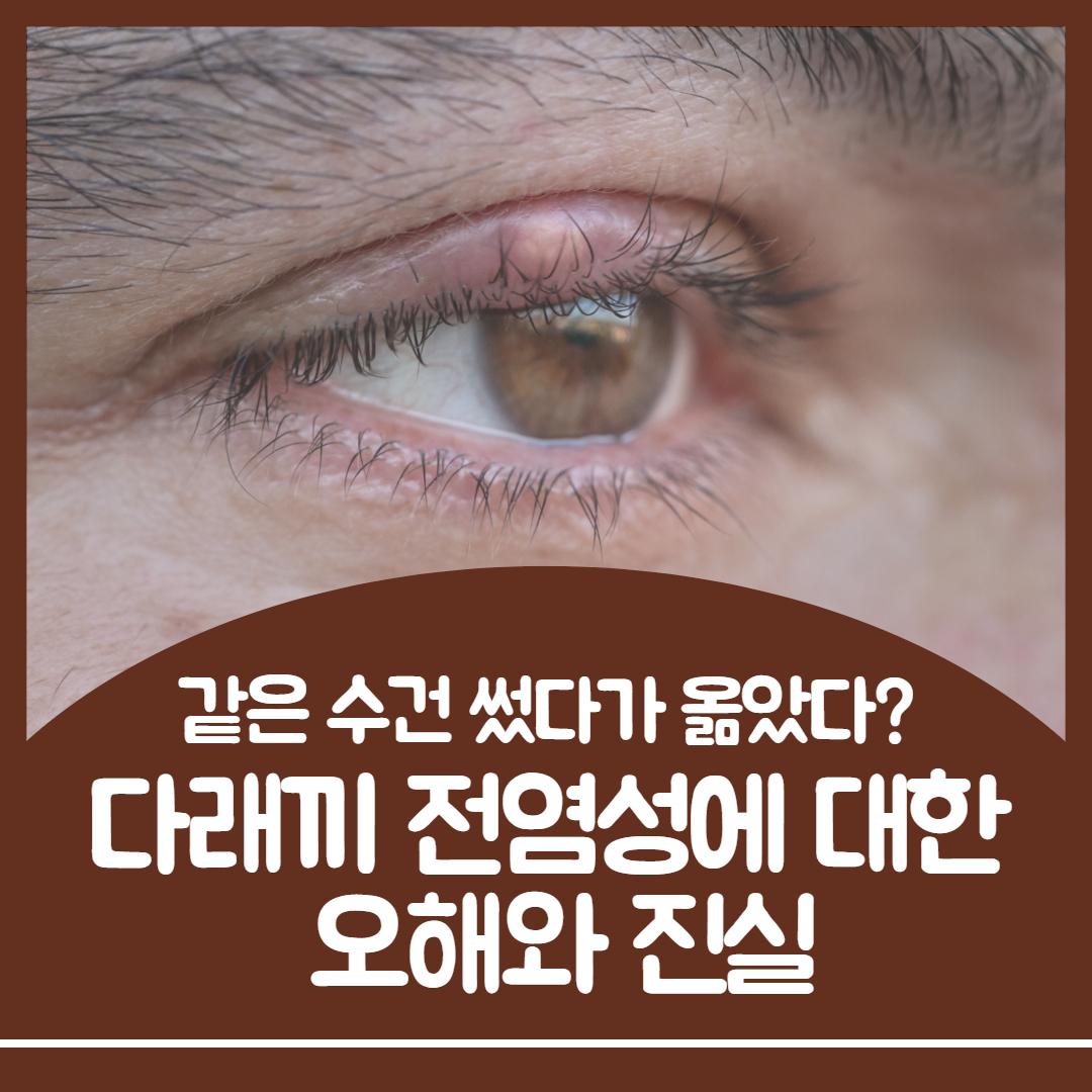 다래끼 전염 1.jpg