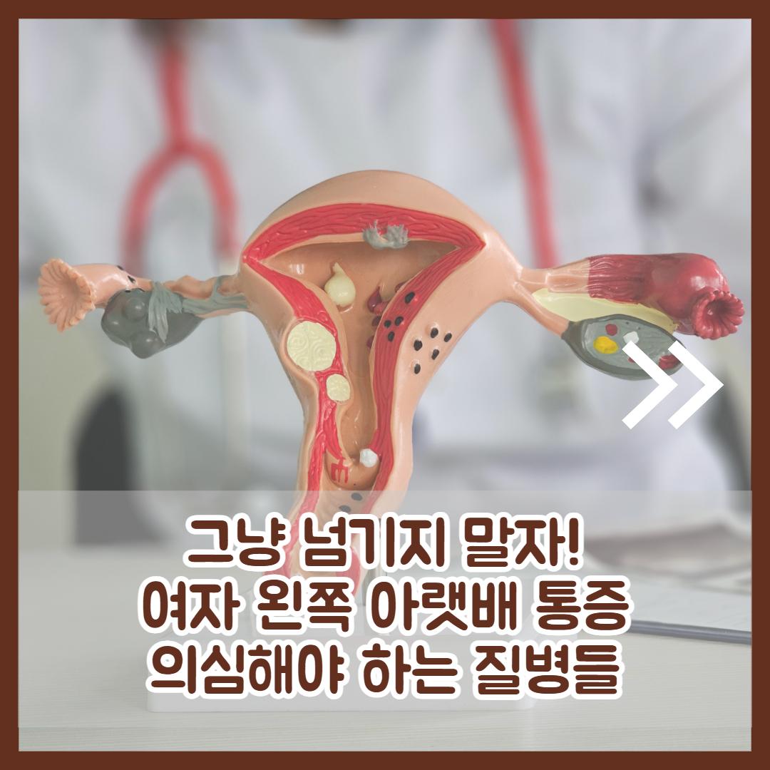 여자 왼쪽 아랫배 통증 2.jpg