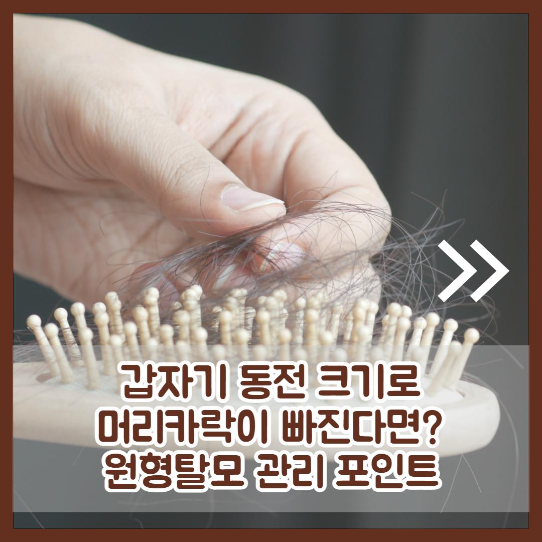 원형탈모 원인2.jpg