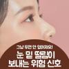 눈 밑 떨림 원인 4가지 제대로 된 관리 방법까지
