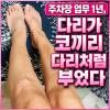 다리 붓기 빼는법 마사지 꿀팁까지 알려드립니다