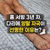 다리 붓기 빼는법 마사지 붓기차 다 소용없다면 이 3가지 챙겨보세요