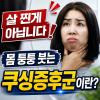 쿠싱증후군 증상 붓기 심해졌다면 꼭 확인하세요