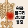 왼쪽 옆구리 갈비뼈 통증 원인과 해결방법