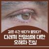 다래끼 전염 여부부터 예방 관리 방법까지